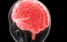 Suýt mất mạng vì viêm xoang lan đến não