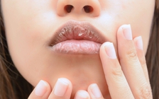 4 dấu hiệu bất thường trên mặt tiết lộ sức khỏe của bạn