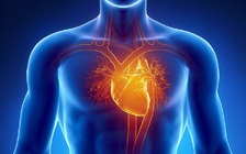 Tim bỗng đập loạn xạ, vì sao, có nguy hiểm không?