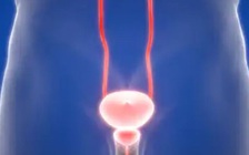 Bác sĩ cũng sốc: Cậu bé nhét dây cáp dài 70 cm vào bàng quang vì tò mò