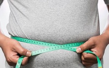 Bị đuổi việc vì... quá mập