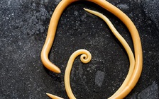 Siêu âm phát hiện giun lớn dị thường ngọ nguậy trong dạ dày chàng trai