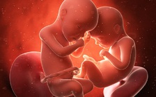 Cặp song sinh kỳ lạ có nội tạng lộn ngược nhau