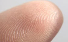 Chuyện kỳ lạ về những người đàn ông không có dấu vân tay