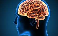 Bị đau cổ dữ dội 8 năm do não trượt xuống đốt sống cổ mà không biết