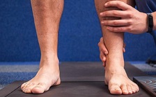 Cao 1,8 mét, người đàn ông vẫn phẫu thuật để cao 1,85 mét