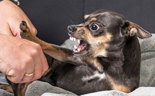 Kinh hoàng vụ bị chó cưng cắn, người phụ nữ phải cắt bỏ 2 bàn tay