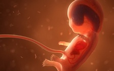 Mẹ mắc Covid-19, thai nhi trong bụng chết lưu cũng dương tính