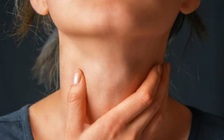 Căn bệnh lạ khiến cô gái cao đến 2 mét, cổ dài đến gần 18 cm