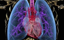 Bé gái chết do bị đâm 2 cây kim dài 10 cm vào tim, phổi