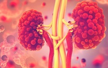 Bệnh lạ: Người phụ nữ sẽ chết nếu uống quá 3 ly nước/ngày