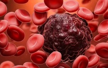 Mỹ: 2 lần vượt qua ung thư, người phụ nữ trẻ lại qua đời vì Covid-19