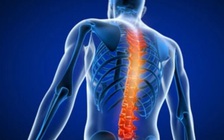 Chú rể gãy xương vì bạn bè chơi trò tung hứng trong đám cưới