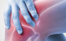 5 cách giúp giảm đau viêm khớp mà không phải uống thuốc