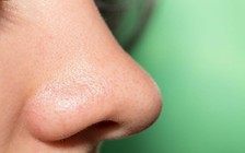 Cô gái chơi dại nhét hạt cườm vào mũi, 20 năm sau mới... nhớ ra