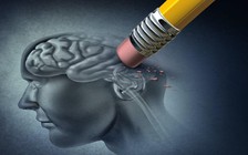 Chuyện lạ: Sau tai nạn ô tô, người đàn ông không thể nhớ gì quá 6 giờ