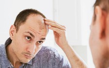 Khoa học phát hiện tác hại bất ngờ khi ăn nhiều chất béo không lành mạnh