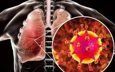 Triệu chứng Omicron giữa người đã tiêm vắc xin và chưa tiêm khác nhau thế nào?