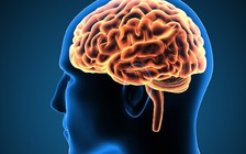 Bác sĩ cũng sốc: Người đàn ông bị nấm đen phát triển trong não