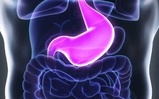 Hậu Covid-19: Cô gái mắc triệu chứng liệt dạ dày hiếm gặp