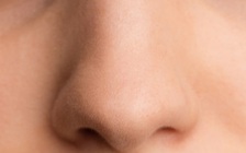 Căn bệnh lạ khiến người phụ nữ bị chảy máu cam suốt 30 năm