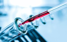 Phương pháp mới có thể phát hiện sớm ung thư vú trong sữa mẹ