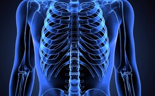 Người phụ nữ bị gãy 3 xương sườn vì đồng nghiệp nam... ôm quá mạnh