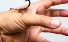 Điều đầu tiên nên làm sau khi bị bọ cạp chích