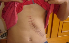 Mua bán thận 300 triệu đồng, 'cò’ ăn phân nửa