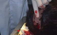 Vụ 'truy sát ở Cà Mau': Bắt một nghi can