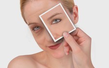 Hai nguyên nhân khiến mắt thâm quầng ít người biết