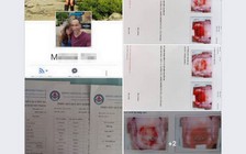 Hồ sơ bệnh án bị tung lên Facebook