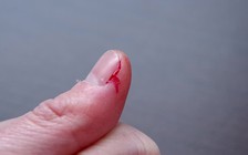 Nước bọt giúp làm lành vết thương