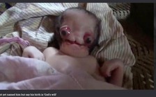 Cha mẹ em bé dị dạng: 'Chúng tôi sẽ không bỏ con'