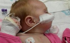 Vá 5 lỗ thủng trong tim cho bé gái 11 tuần tuổi