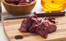 Những thực phẩm nên hạn chế để tránh bị cholesterol cao