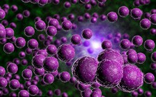 Phát hiện vi khuẩn mới gây viêm mô tế bào chưa có trong y văn