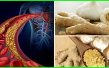Hỗn hợp gừng, tỏi và mật ong giúp điều trị mỡ máu cao