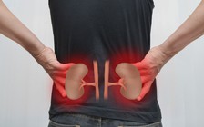 Bạn có biết làm gì để 'giải độc' thận chưa?