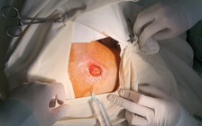 Vụ thử máy X-Quang trên đùi, nhiều kỹ thuật viên nhập viện: Dùng máy X-quang chơi bạc bịp