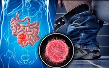 6 dấu hiệu cảnh báo ung thư ruột đã di căn đến xương