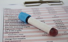 Xét nghiệm máu có thể giúp một người phát hiện nguy cơ bị đau tim hay không