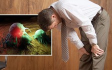 Các triệu chứng phổ biến nhất của u não, chớ coi thường!