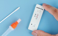 Bao lâu sau khi tiếp xúc với F0 thì test có kết quả chính xác?