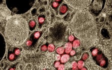 Phát hiện mới: Triệu chứng hậu Covid-19 khác nhau ở từng biến thể