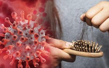 4 triệu chứng bất thường của Covid-19 có thể kéo dài, bạn cần cảnh giác!