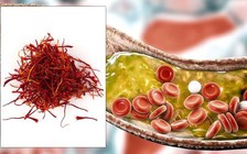 Phát hiện mới: Loại thảo dược này làm giảm 50% mức cholesterol chỉ sau 3 tuần