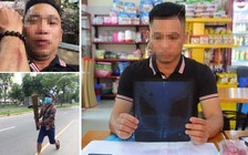 Người nghi bị nhóm 'tiếp thị sữa' hành hung: 'Tôi bị người lạ đánh, bắt xóa clip'