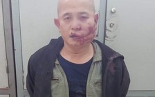 Bị bắt vì trộm chó