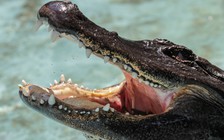 Sống sót thần kỳ sau khi bị cá sấu ngoạm đầu